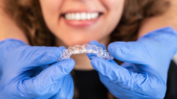 Invisalign 2