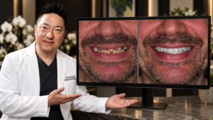before and after dental implant at Complete Dental Works showing solution for patients wondering how to stop your teeth from falling out