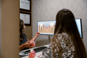 illustration of bone loss around a missing tooth showing why patients need to know how to stop your teeth from falling out